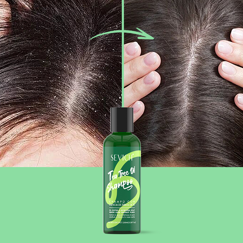 Çay Ağacı Özü Şampuan Saç Krem - Hair Care Essence incelemesi ve fiyatı