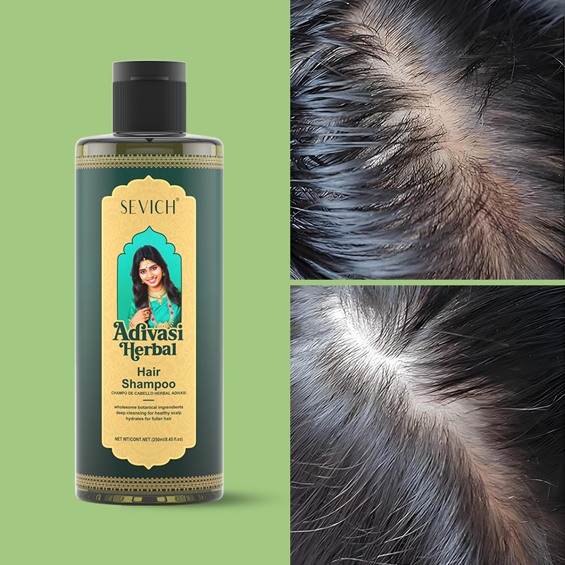 SEVICH Bitkisel Saç Büyüme Yağ - Hair Care India incelemesi ve fiyatı