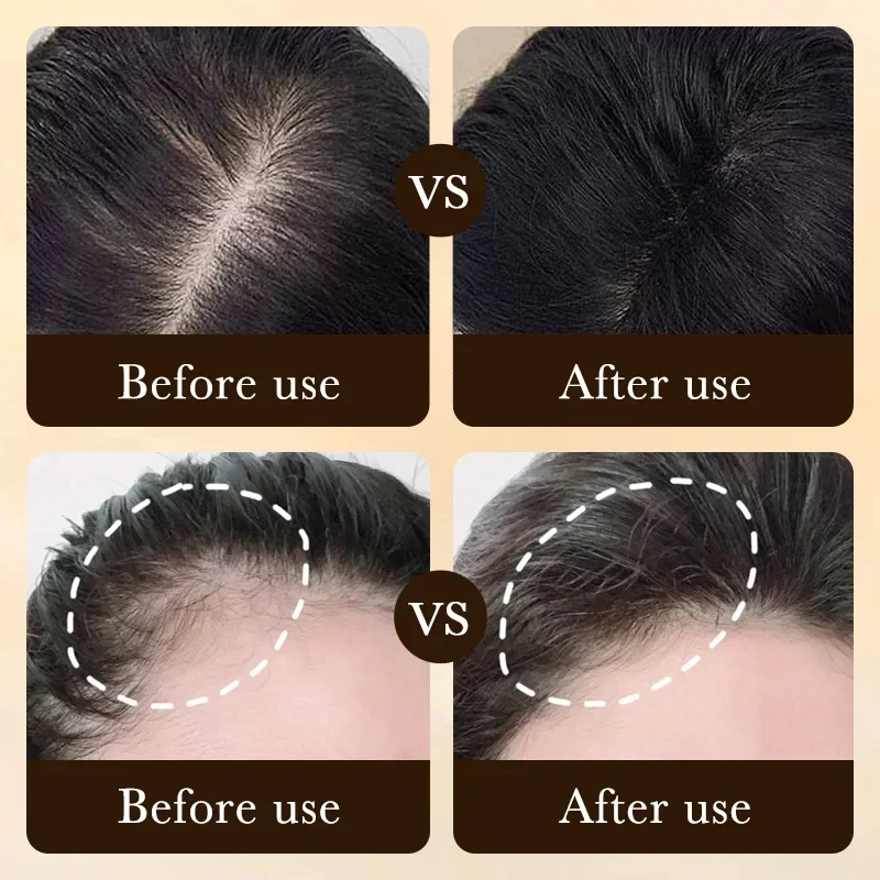 Biotin Hızlı Saç Uzatma Yağı Ü - Hair Care Essence Oil Spray incelemesi ve fiyatı