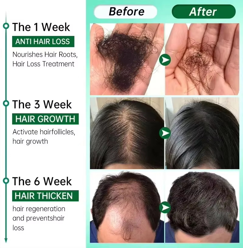 Saç Büyüme Serumu 7 Gün Hızlı  - Hair Care Capsule incelemesi ve fiyatı