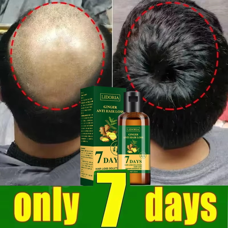 Saç Büyüme Serumu 7 Gün Hızlı  - Hair Care Capsule incelemesi ve fiyatı