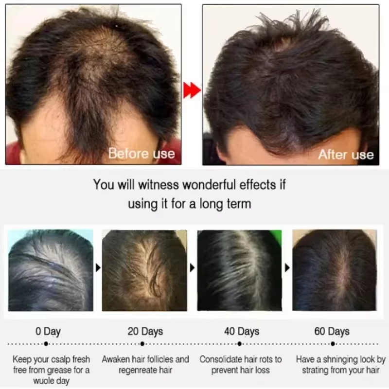Saç Büyüme Serumu 7 Gün Hızlı  - Hair Care Capsule incelemesi ve fiyatı