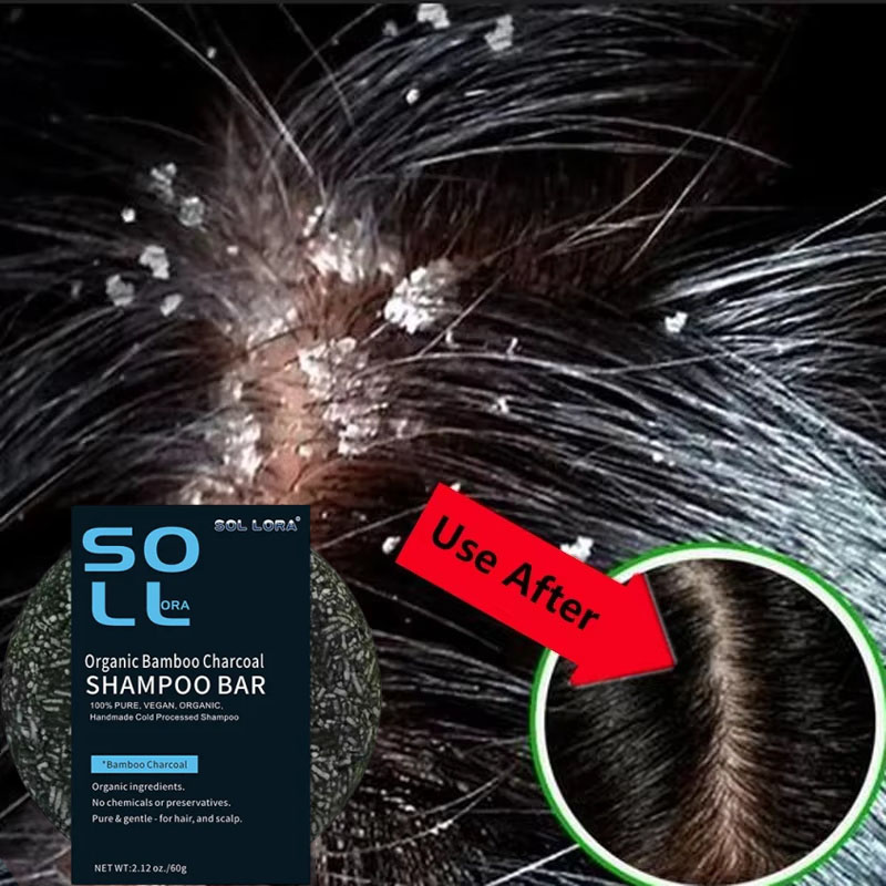 Hızlı Kepek Önleyici Saç Bakım - Hair Care Dandruff incelemesi ve fiyatı