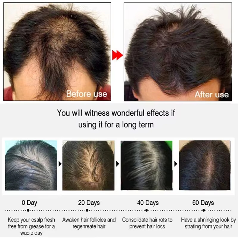 Hızlı Zencefilli Saç Uzatma Sp - Hair Care For Hair Loss incelemesi ve fiyatı