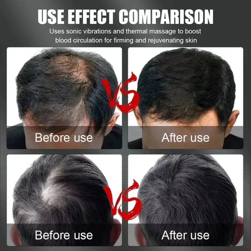 660nm 850nm Kırmızı Işık Kızıl - Hair Care For Hair Loss incelemesi ve fiyatı